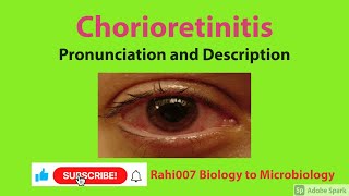 Chorioretinitis  #YoutubeShorts