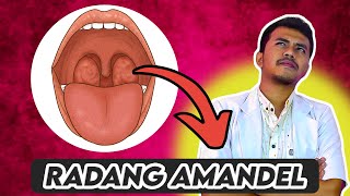 Radang Amandel - Gejala, Penyebab dan Pengobatannya