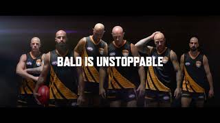 Continental Tyres Australia Bald Stars 60SEC