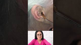 Dr.Natacha, earwax removel satisfying video.