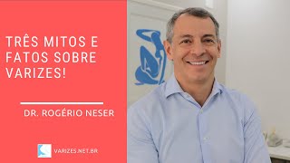 Três mitos e fatos sobre varizes!