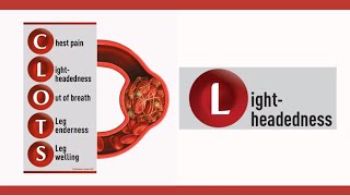 Light-headedness - the second word in CLOTS