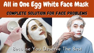 Egg White Face Mask for Open Pores | DIY Egg White Face Mask-All in One Face Mask Healthcare Remedy