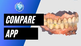 Medit Compare App