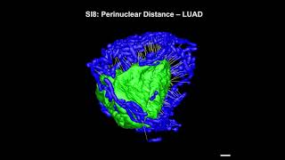 Mitochondrial networks in lung cancer