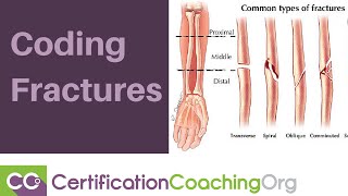 Coding Fractures