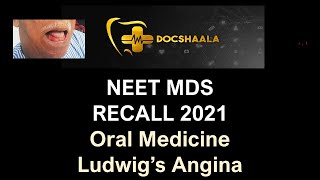 NEET MDS Recall 2021-  Ludwig's Angina - Oral Medicine