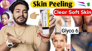 Glyco 6 Cream Review | Wonderful Results Of Glyco 6 Cream