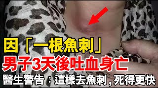 一頓開心晚飯，因為「一根魚刺」，男子3天後吐血身亡！醫生警告：這樣去除魚刺，會死得更快！