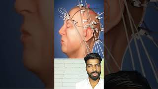 Brain Electrical Activity EEG Electroencephalogram #shorts #youtubeshorts #medicaleducation