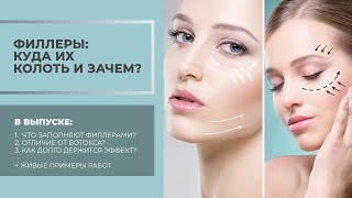 Птоз: почему лицо "обвисает" и как с этим бороться?