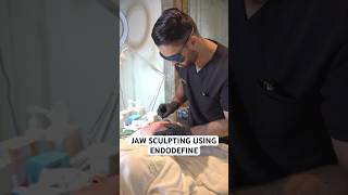 Jaw Sculpting Using EndoDefine