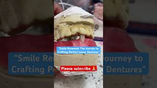 “Smile Renewed: The Journey to Crafting Perfect Lower Dentures”#shortvideo #dentures #fypシ