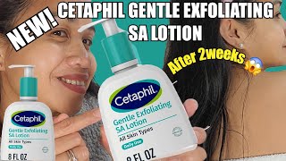 NEW CETAPHIL GENTLE EXFOLIATING SA LOTION/ FOR SKIN WITH COLOUR/ ALL SKIN TYPES