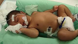 Medical Education Video: Neonatology: Focal Clonic Seizures in Newborn