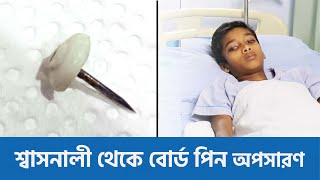 শ্বাসনালী থেকে বোর্ড পিন অপসারণ বিআরবি হসপিটালে