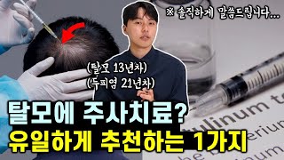 탈모 주사 진짜 효과 있을까..? 솔직하게 말씀드립니다. (추천 vs 비추천)