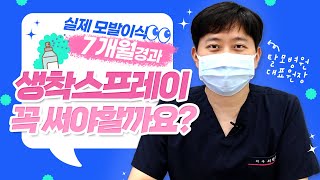 [Mobien TV] 원장님이 직접 모발이식 후 생착스프레이 꼭 써야하는 이유! #광주모발이식