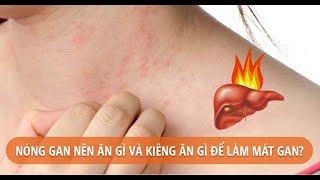 Người nóng gan nên và không nên ăn uống gì?