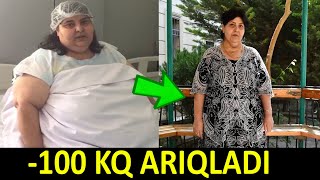 100 kq arıqlayan Azərbaycanlı qadın - Görün necə etdi!