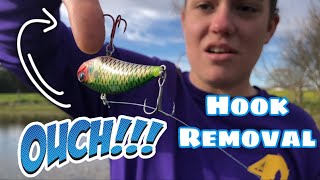 How to Remove a Hook Pass the Barb!!!