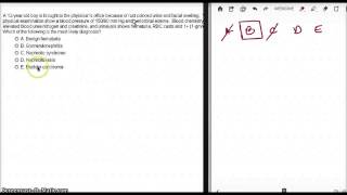 516 POST STREPTOCOCCAL GLOMERULONEPHRITIS EXAMPLE 1