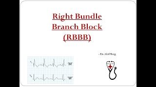 Right Bundle Branch Block : Dr. Akif Baig