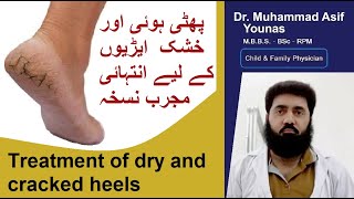 How to treat cracked  dry heels | crack heel treatment | cracked heels home remedy