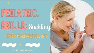 Pediatric Suckling Skills - Finger Walking Pull In's