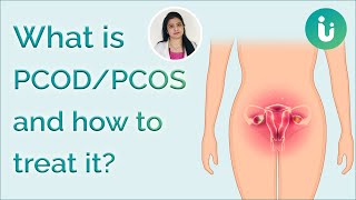 What is PCOD/PCOS? What are its symptoms & causes? How to control PCOS & what is its treatment