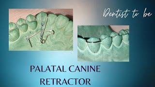 How to fabricate a palatal canine retractor