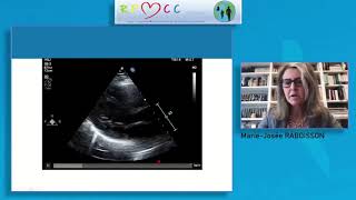 Session «Imagerie et Echographie» - RFMCC pratique 2020