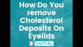 How Do You Remove Cholesterol Deposits On Eyelids ? - By XANTHEL ® Easy Xanthelasma Removal !