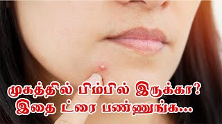 முகத்தில் பிம்பிள் அதிகம் வருதா?...இதை ட்ரை பண்ணுங்க