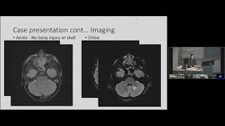 SPH Medicine Medical Grand Rounds 23Jan2020