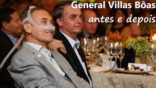 GENERAL VILLAS BÔAS: ANTES E DEPOIS