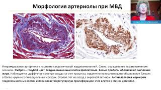 Микроваскулярная дисфункция при острых и хронических формах ИБС: клиническое значение