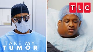 RISKIEST Tumor Removals | Take My Tumor | TLC