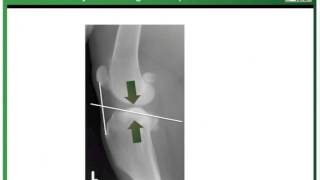 "How does cruciate surgery work?"