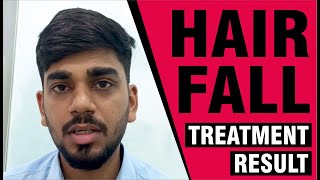 Amazing Hair Fall and Dandruff Treatment Success Story! Sakhiya skin clinic Review