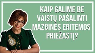 Kaip galime be  vaistų pašalinti Mazginės eritemos  priežastį? - Gyd. Jelena Tulčina