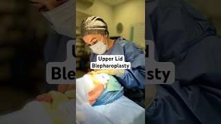 👀 Ever wondered what goes on behind the scenes of an upper eyelid blepharoplasty? #blepharoplasty