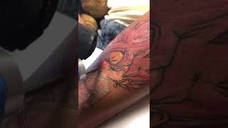 Laser tattoo removal of Anime tattoo