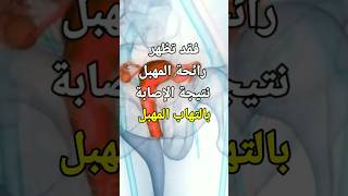 التهابات المهبل وكيفية التخلص من الرائحة الكريهه #shorts