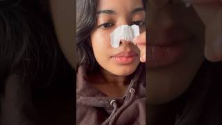 Blackhead Removal in 10 mins #blackheadremoval