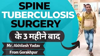 Spine tuberculosis surgery के 3 महीने बाद | Spinal TB Treatment in Delhi