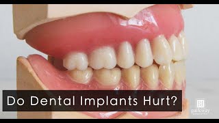 The Dental Implants Experience - Do Dental Implants Hurt?