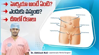 హెర్నియా అంటే ఏమిటి? | Types of Hernia | Hernia Symptoms and Treatment in Telugu | Dr Abhilash Nali