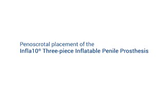 Penoscrotal placement of the Infla10® Inflatable Penile Prosthesis