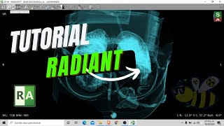 🟢⚪👨🏻‍💻Tutorial Radiant (RadiAnt) DICOM🟢⚪👨🏻‍💻